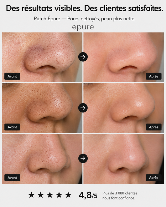 Epure Patch Nez